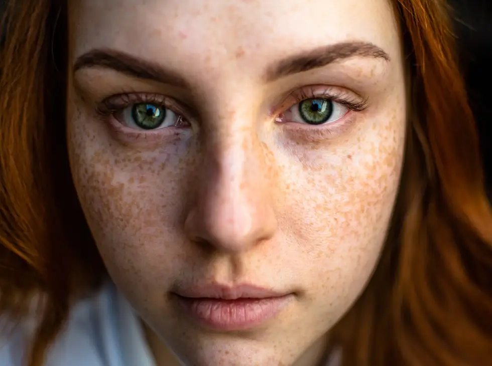 How to Get Rid of Cystic Acne With CBD